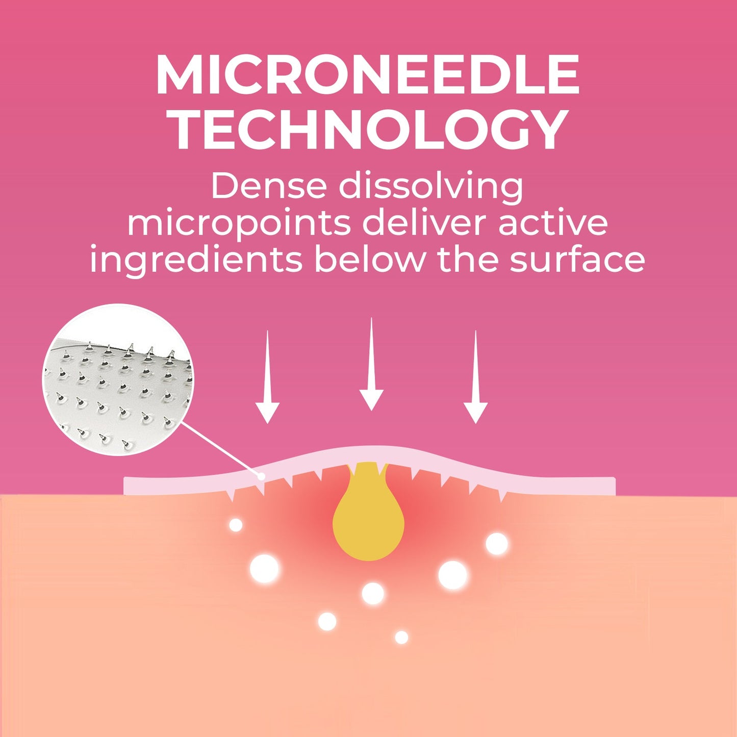 Microdart Pimple Patch Invisible Hydrocolloid Acne Patches for All